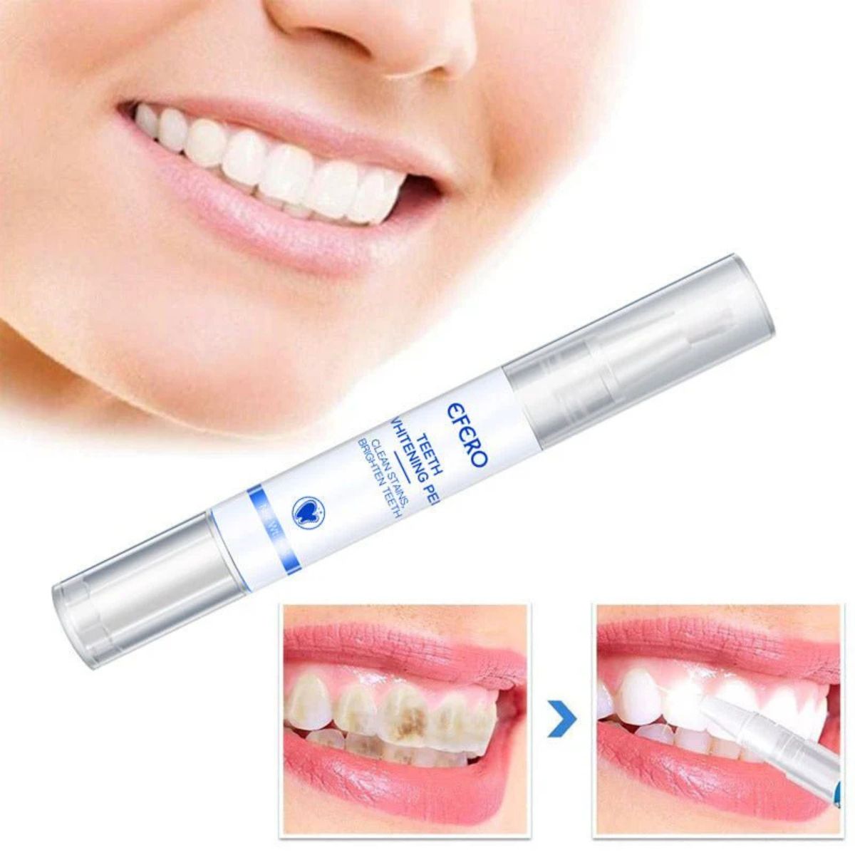 Teeth Whitening Pen Cleaning Serum – Dental Tools for Oral Care & Stain Removal