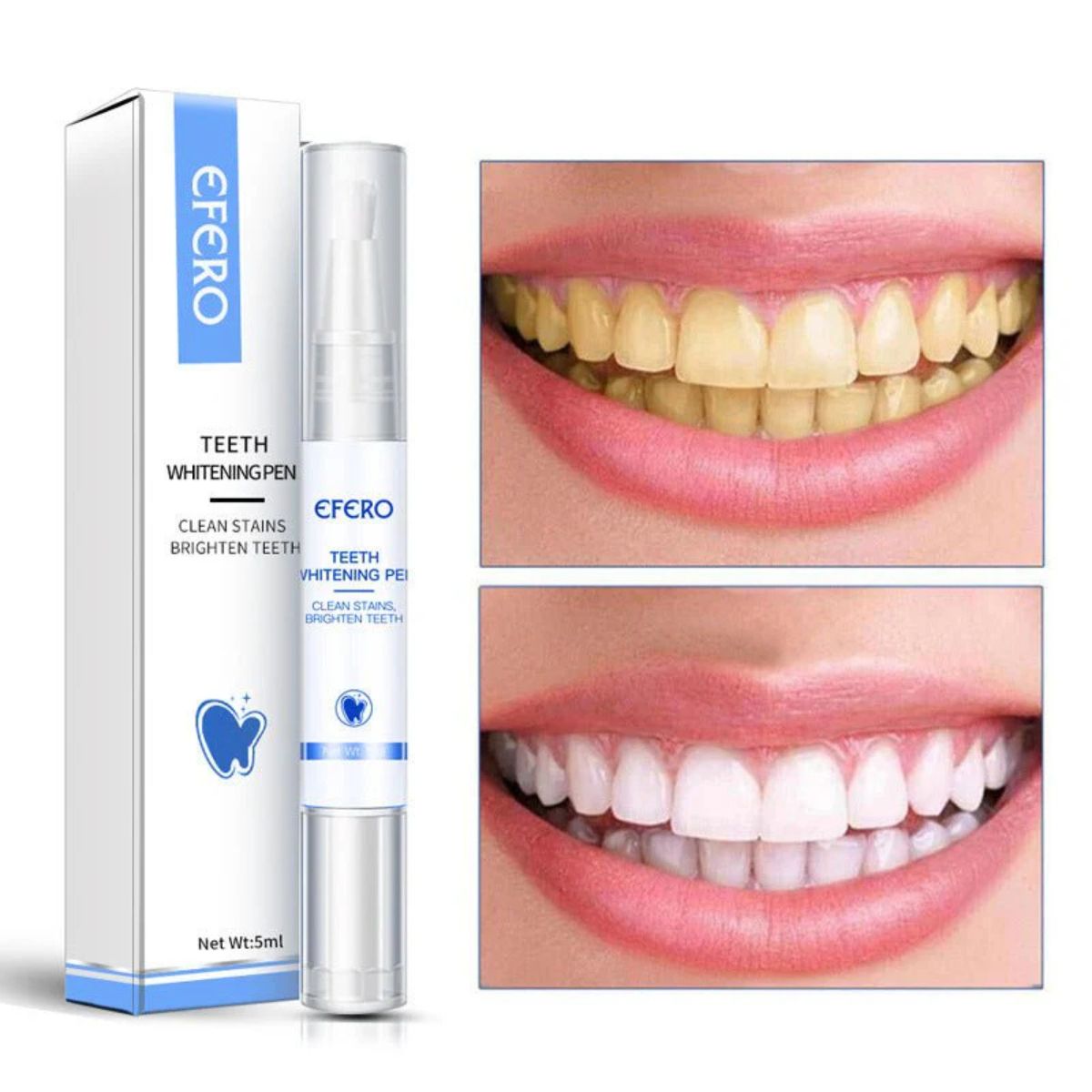 Teeth Whitening Pen Cleaning Serum – Dental Tools for Oral Care & Stain Removal