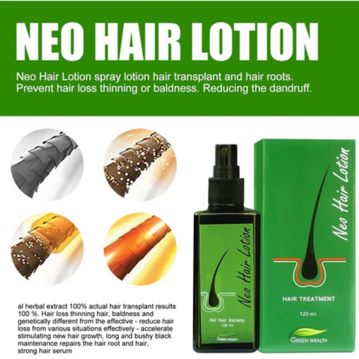 Hair Care Growth Lotion Spray 120ml – Anti hair loss serum essence for natural hair growth and scalp nourishment