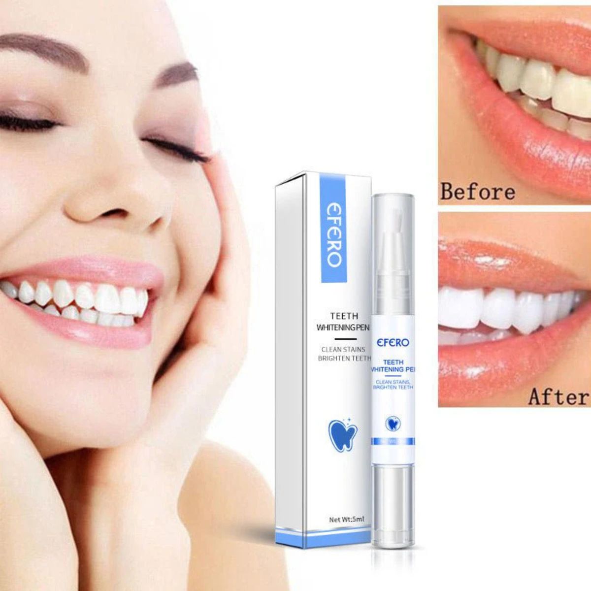 Teeth Whitening Pen Cleaning Serum – Dental Tools for Oral Care & Stain Removal