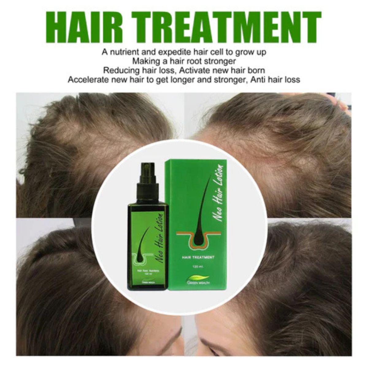 Hair Care Growth Lotion Spray 120ml – Anti hair loss serum essence for natural hair growth and scalp nourishment