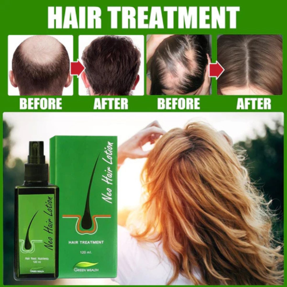 Hair Care Growth Lotion Spray 120ml – Anti hair loss serum essence for natural hair growth and scalp nourishment